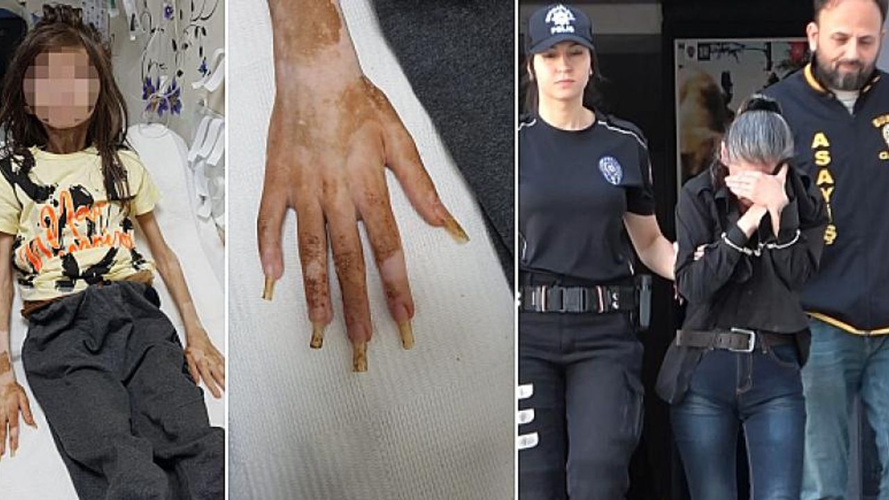 9 yaşındaki çocuk 1 yıldır çöp evde kilitli tutulmuş!
