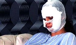 Diyarbakır'da eşinin yüzünü paramparça etti, tahliye oldu