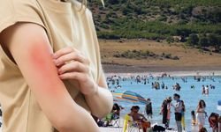 Türkiye'de Vibrio alarmı: Bakanlıktan açıklama geldi