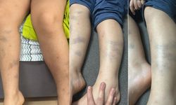 Diyarbakır’daki okulda öğrenciye darp iddiası: Yeni gelişme!