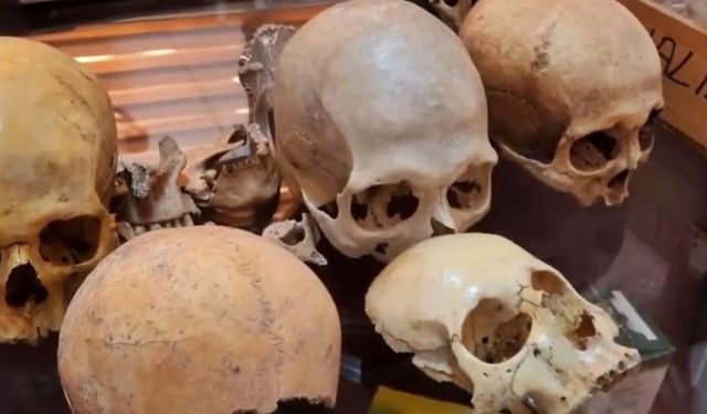 Diyarbakır’da bulunan Orta Çağ dönemi kemikleri Kürtlere ait çıktı!