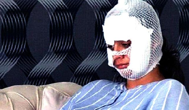Diyarbakır'da eşinin yüzünü paramparça etti, tahliye oldu