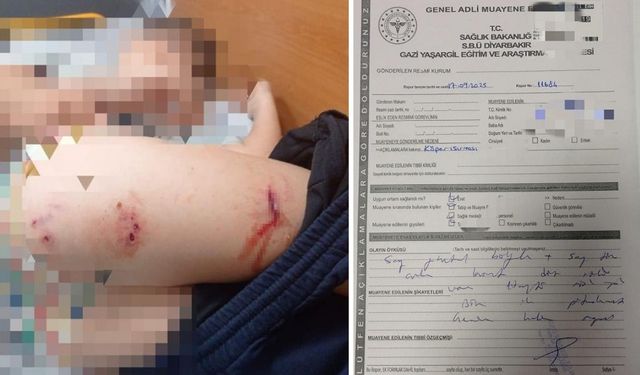 Diyarbakır’da bir çocuğa köpek saldırdı!