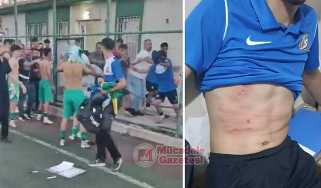 Şanlıurfa’da saha karıştı: Diyarbakırlı futbolcular yaralandı!