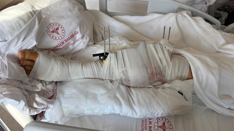 Muhtar, Evlilik Hazırlığı Yapan Eski Damadını Vurdu Tutuklandı! (1)-1
