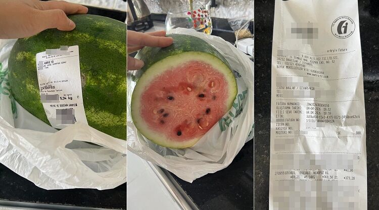 Dışı Seni Içi Beni Yakar! Diyarbakır’da Satılan Karpuz Çocuğu Hastanelik Etti (3)